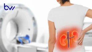 How Fast Can a Kidney Infection Kill You? Symptoms & Care Tips|Bestwrites