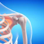 Why Only Males Can Donate Bone Marrow | Full Guide