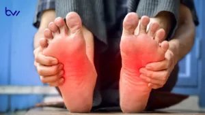 What Is Foot Corn Disease